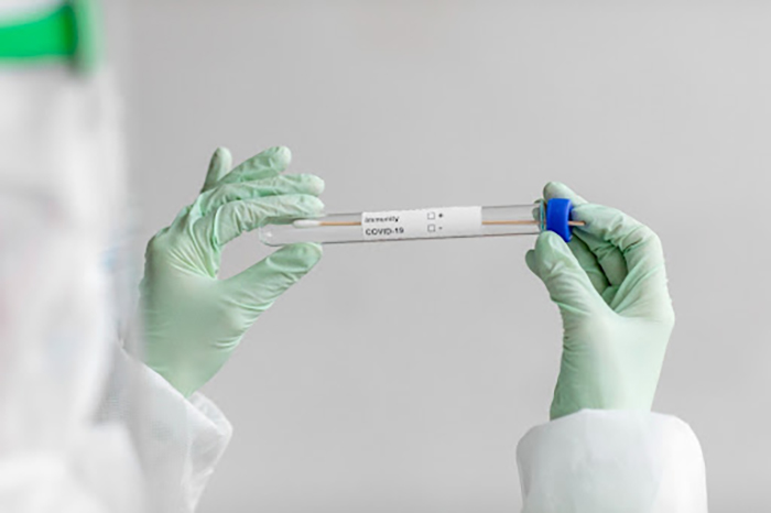Test nhanh kháng nguyên được sử dụng phổ biến để sàng lọc sớm các F0 trong cộng đồng