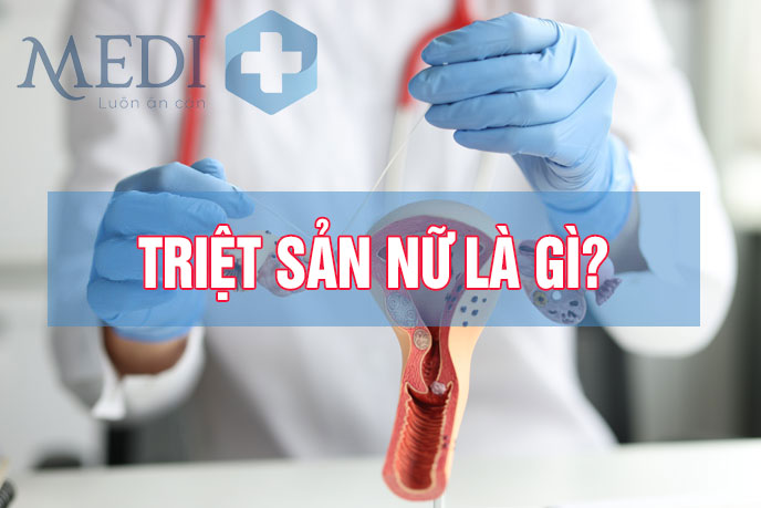 Triệt sản nữ là gì? Những điều bạn cần biết