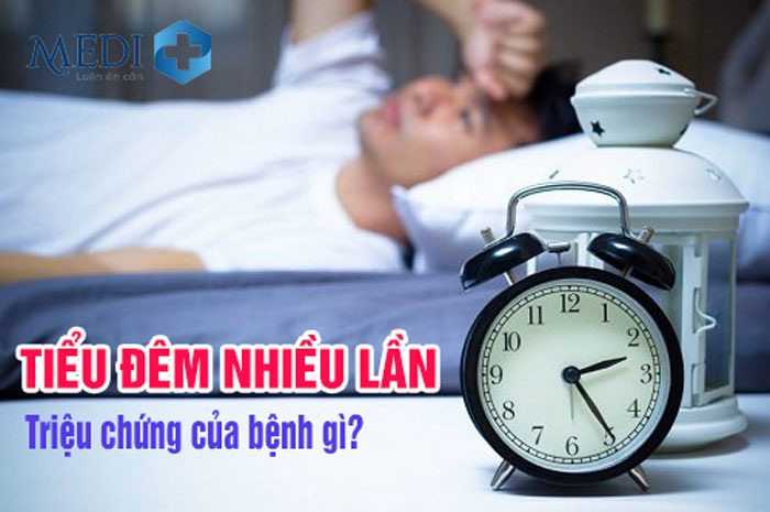 Tiểu đêm nhiều lần là triệu chứng của bệnh gì?