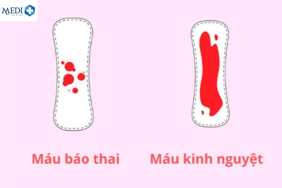 Dấu hiệu nhận biết máu báo thai sau khi quan hệ