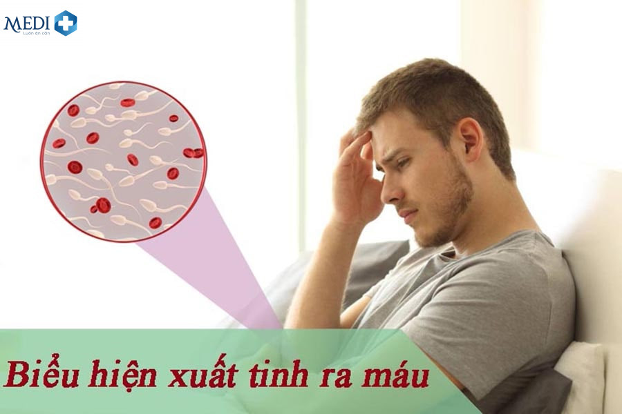 Xuất tinh ra máu khi quan hệ tình dục gây ra bởi nhiều nguyên nhân