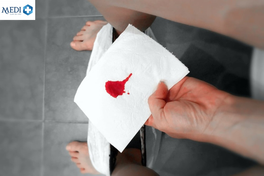 Vừa hết kinh quan hệ ra máu có bầu không? 4 cách tránh thai
