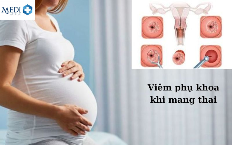 Tác hại của viêm nhiễm phụ khoa trong thai kỳ 