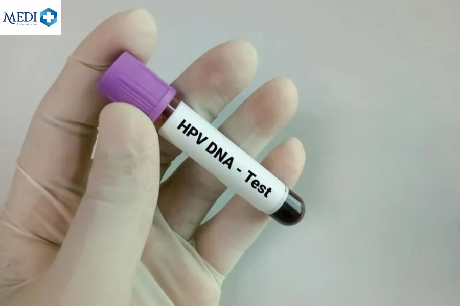 Tiêm ngừa HPV để phòng bệnh sùi mào gà