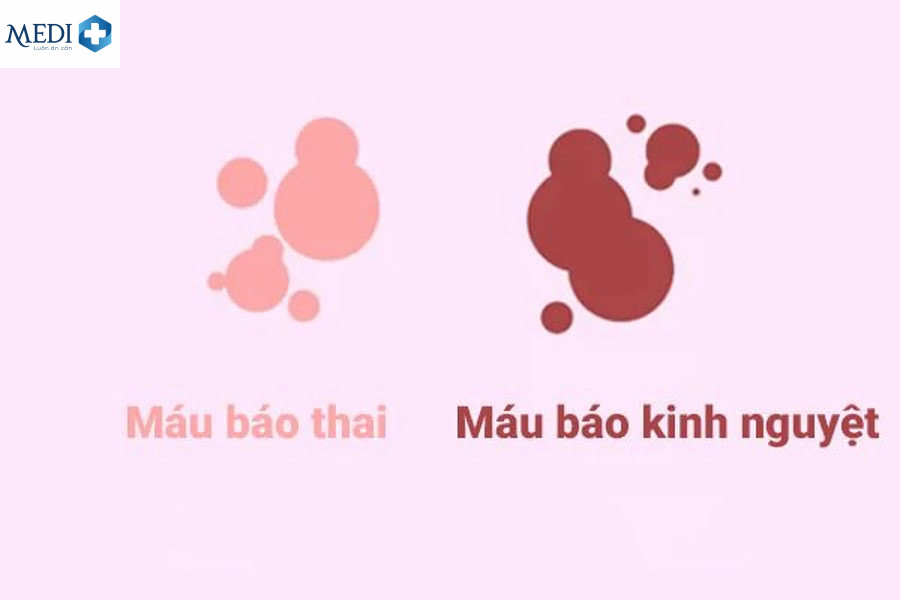 Quan hệ lần đầu ra máu mấy ngày thì hết?