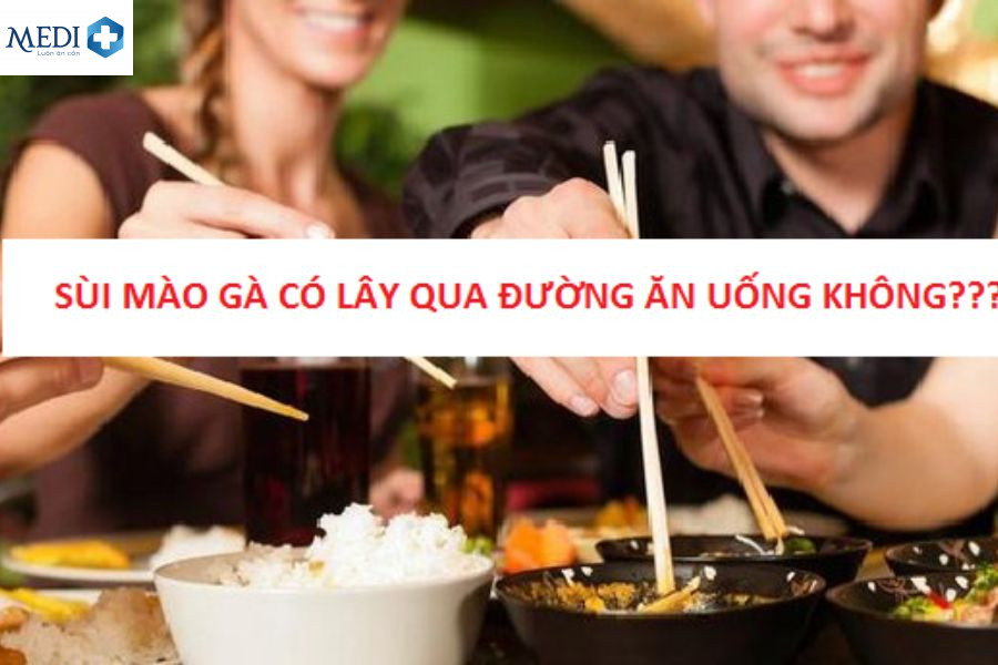 Sùi mào gà có lây qua đường ăn uống không?