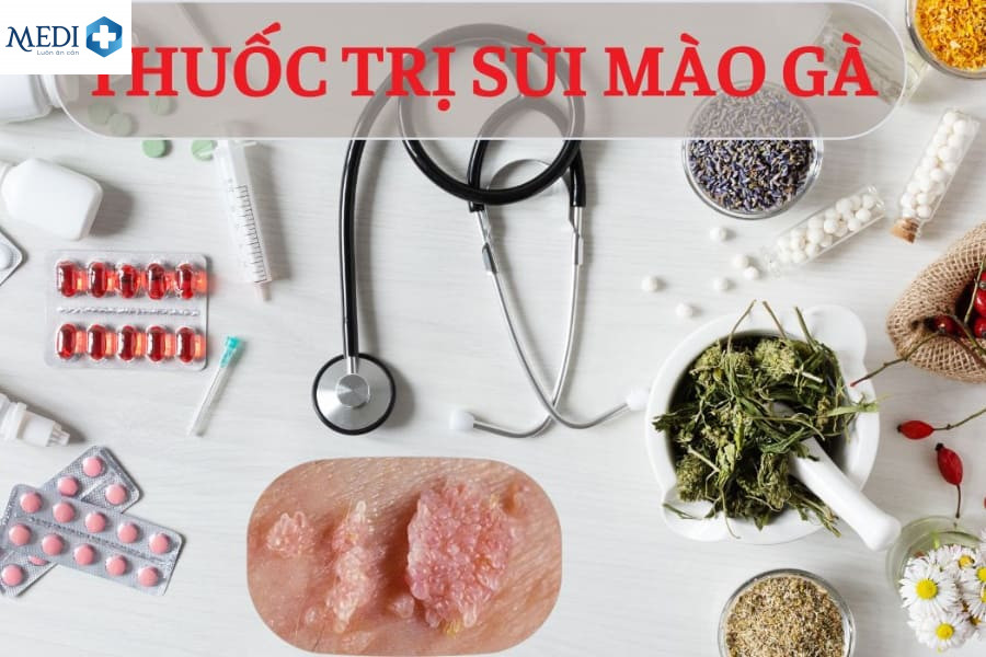 Cách trị sùi mào gà có hiệu quả cao bằng thuốc