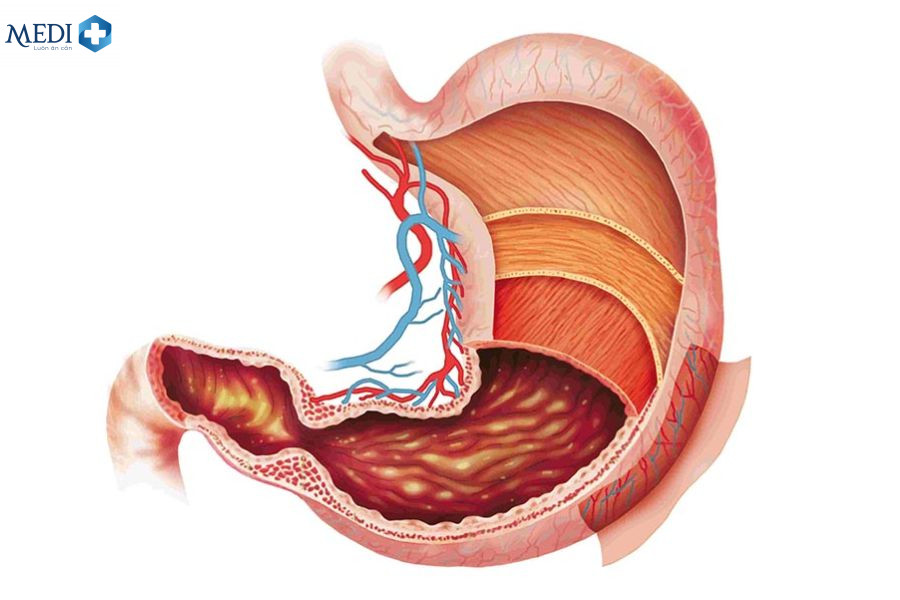 Cấu tạo và chức năng dạ dày