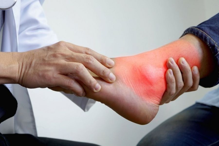 Người bị gout là những người không nên ăn măng khô, măng tươi