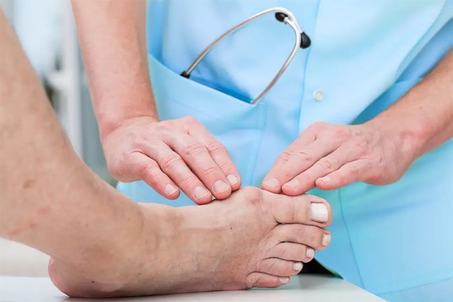 Bệnh gout có chữa khỏi được không?