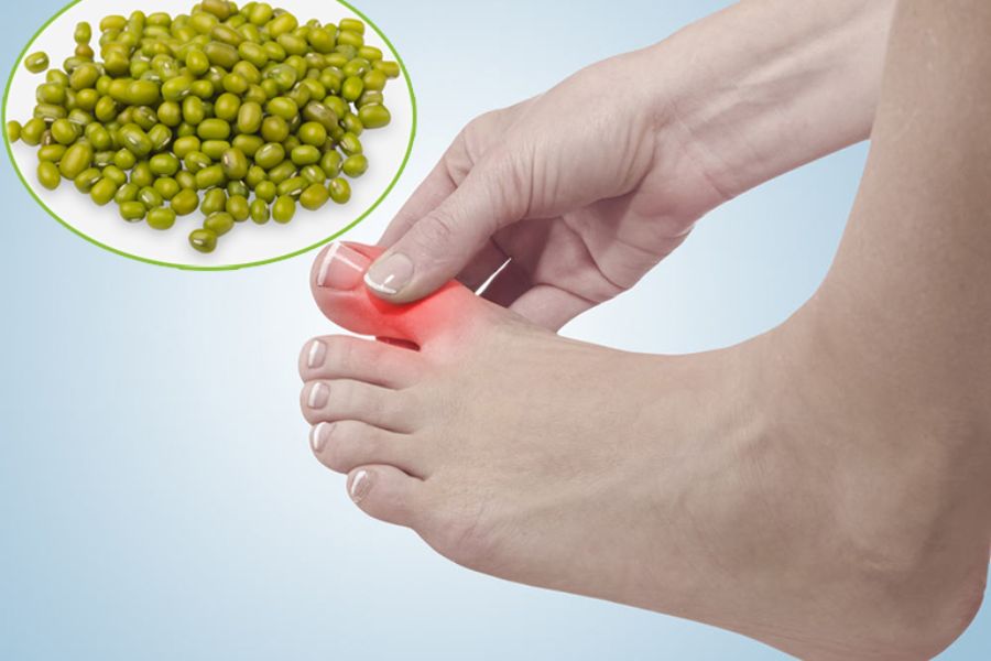 Chữa bệnh gout không cần dùng thuốc bằng đậu xanh