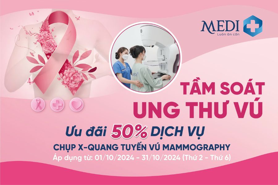 Giảm 50% dịch vụ chụp X-quang tuyến vú Mammography đối với khách hàng nữ đến thăm khám tại Mediplus từ thứ 2 đến thứ 6 hàng tuần