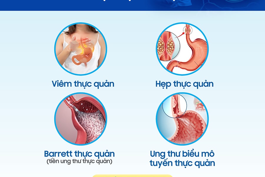 Những biến chứng ở bệnh nhân trào ngược dạ dày thực quản